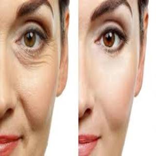 Botox Treatment Clinic in Jodhpur