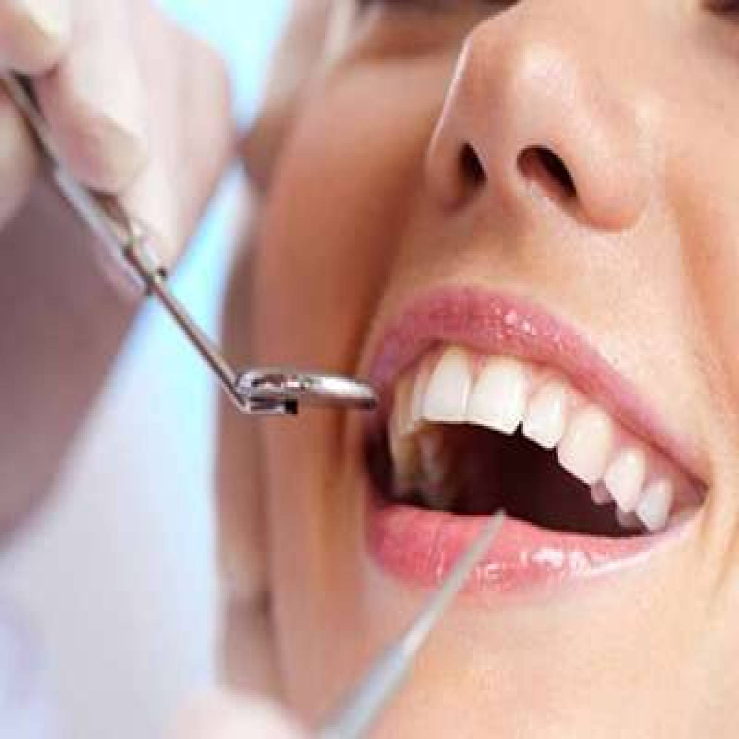 Dental Treatments in Jodhpur