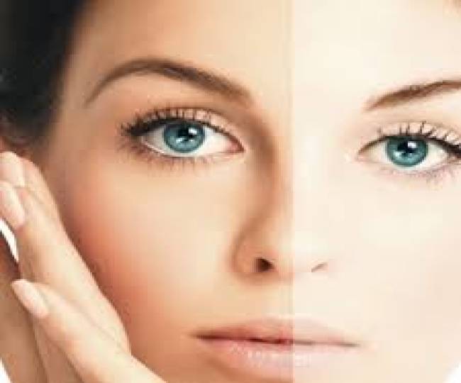 Pigmentation & Skin Whitening Clinic in Jodhpur