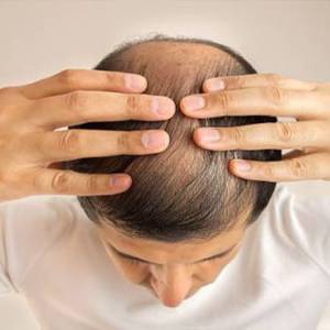 Sapphire FUE Hair Transplant Clinic in Jodhpur